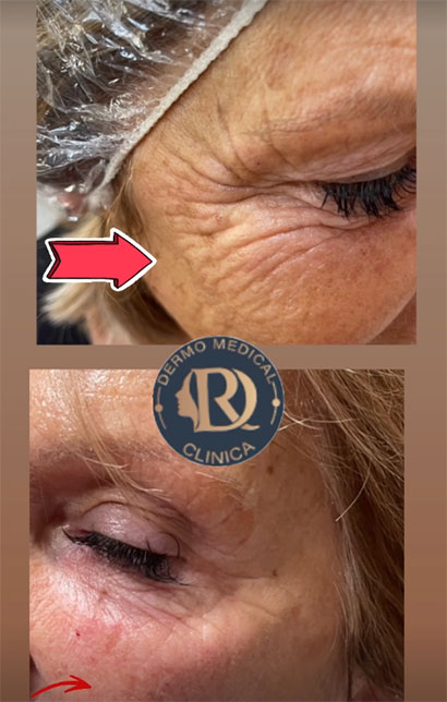 Soins du visage anti-âge