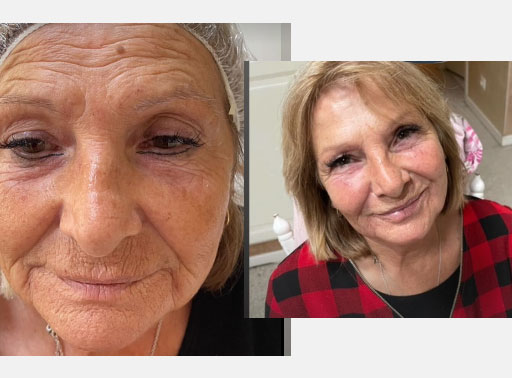 Soins du visage anti-âge