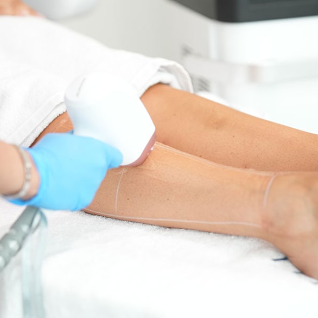 Jambes entières