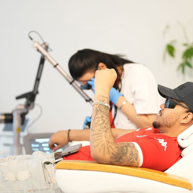 Pico Laser Tattoo Removal in Brussels