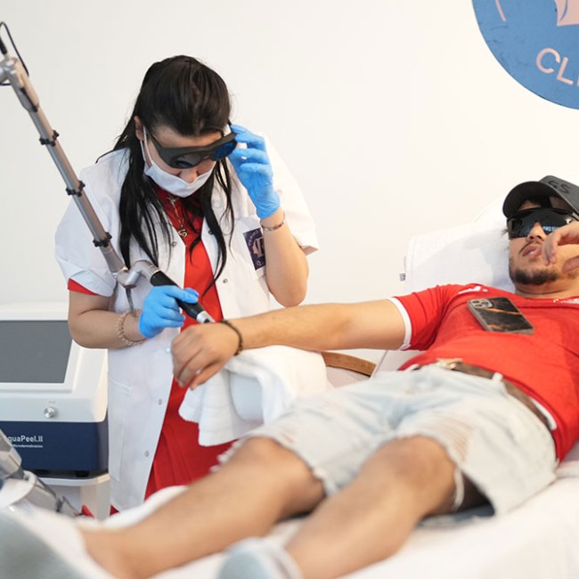 Pico Laser Tattoo Removal in Brussels
