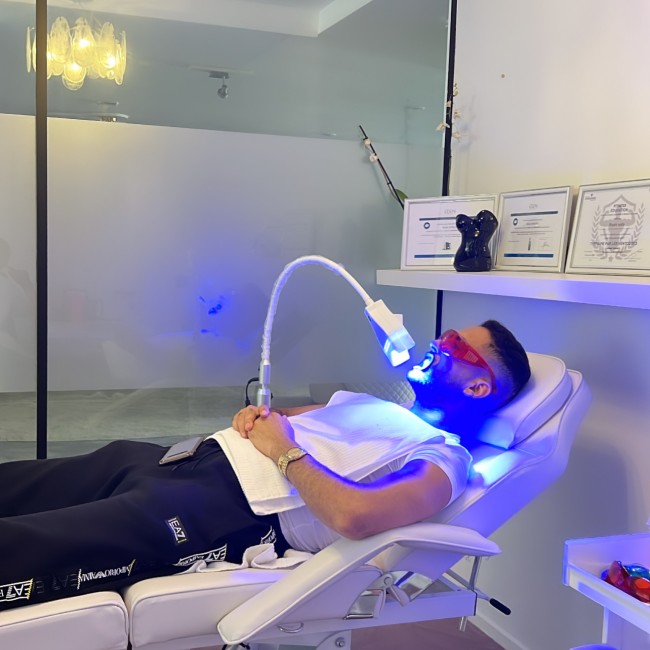 Laser tooth whitening