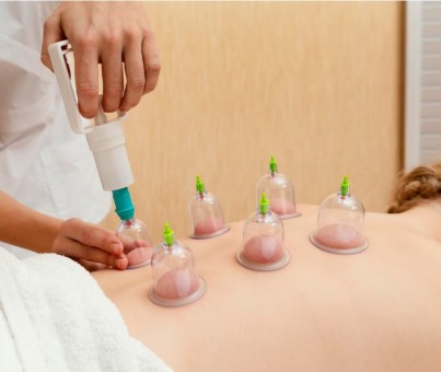 Hijama & Cupping
